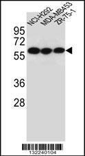 Anti-CHRNA10 Rabbit Polyclonal Antibody (HRP (Horseradish Peroxidase))