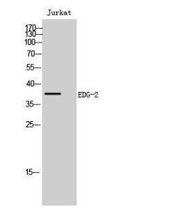 Western blot analysis of Jurkat cells using Anti-EDG2 Antibody