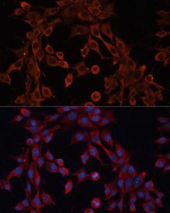 Immunofluorescence analysis of NIH-3T3 cells using Anti-ABCA12 Antibody (A305525) at a dilution of 1:100 (40x lens) DAPI was used to stain the cell nuclei (blue)