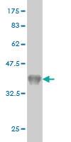 Anti-CYP26B1 Mouse Monoclonal Antibody [clone: 1H6]