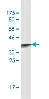 Anti-PIK3R4 Mouse Monoclonal Antibody [clone: 1D4]