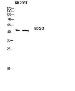 Western blot analysis of KB 293T lysis using Anti-EDG2 Antibody