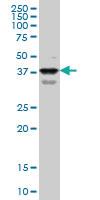 Anti-PBX1 Mouse Monoclonal Antibody [clone: 3F7]