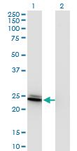 Anti-BIN3 Mouse Monoclonal Antibody [clone: 4E12]