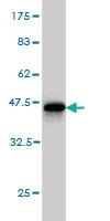 Anti-GREM1 Mouse Monoclonal Antibody [clone: 4C2]