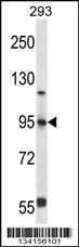 Anti-FOXP4 Rabbit Polyclonal Antibody