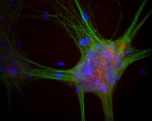 Mixed neuron-glial cultures stained with Mouse monoclonal antibody to alpha Synuclein [3H9] BSENM-1402-100 (red) and Chicken polylclonal antibody to MAP2 BSENC-1382-50 (green). The alpha Synuclein antibody stains vesicular structures the perikarya and processes of the neurons in this image.