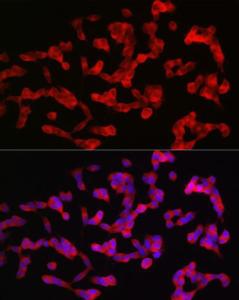 Immunofluorescence analysis of SH-SY5Y cells using Anti-ANK-3 Antibody (A306440) at a dilution of 1:100 (40X lens). DAPI was used to stain the cell nuclei (blue)