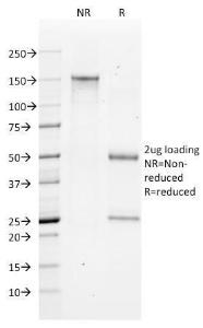 SDS-PAGE analysis of Anti-Bax Antibody [2D2] under non-reduced and reduced conditions; showing intact IgG and intact heavy and light chains, respectively. SDS-PAGE analysis confirms the integrity and purity of the antibody