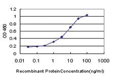 Anti-PBX1 Mouse Monoclonal Antibody [clone: 3F7]