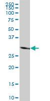 Anti-MAPRE1 Mouse Polyclonal Antibody