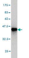 Anti-GREM1 Mouse Monoclonal Antibody [clone: 2F1]