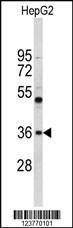 Anti-ELOVL2 Rabbit Polyclonal Antibody (AP (Alkaline Phosphatase))