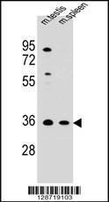 Anti-ASB17 Rabbit Polyclonal Antibody (AP (Alkaline Phosphatase))