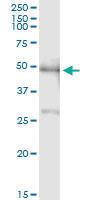 Anti-PBX2 Rabbit Polyclonal Antibody