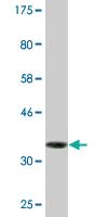 Anti-NUBP1 Mouse Monoclonal Antibody [clone: 2B11]