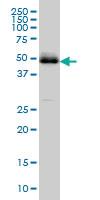 Anti-PBX2 Mouse Monoclonal Antibody [clone: 2E9]