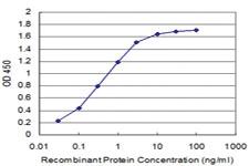 Anti-KCNK10 Mouse Monoclonal Antibody [clone: 1C1]