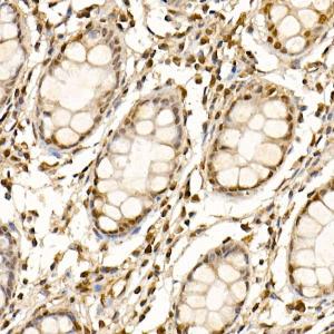 Immunohistochemistry analysis of paraffin-embedded human colon tissue using Anti-Cullin 1/CUL-1 Antibody (A306441) at a dilution of 1:50 (40X lens). Perform high pressure antigen retrieval with 10 mM citrate buffer pH 6.0 before commencing with IHC staining protocol