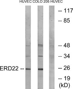 Western blot analysis of lysates from HUVEC and COLO cells using Anti-ERD22 Antibody. The right hand lane represents a negative control, where the antibody is blocked by the immunising peptide.