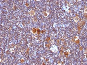 Immunohistochemical analysis of formalin-fixed, paraffin-embedded human Hodgkin's lymphoma using Anti-Bax Antibody [SPM336]