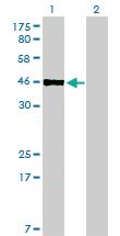 Anti-PBX2 Mouse Monoclonal Antibody [clone: 2E9]