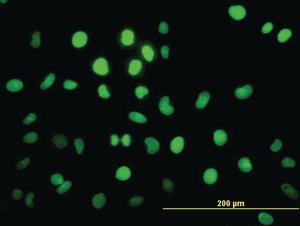 Anti-PBX2 Mouse Monoclonal Antibody [clone: 2E9]