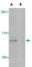 Anti-GP6 Rabbit Polyclonal Antibody