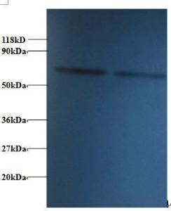 Anti-P4HB Rabbit Polyclonal Antibody (FITC (Fluorescein Isothiocyanate))