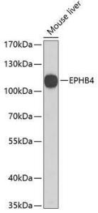 Western blot analysis of extracts of mouse liver, using Anti-Eph receptor B4/HTK Antibody (A11629) at 1:1000 dilution. The secondary Antibody was Goat Anti-Rabbit IgG H&L Antibody (HRP) at 1:10000 dilution. Lysates/proteins were present at 25 µg per lane