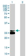 Anti-TREM1 Mouse Polyclonal Antibody