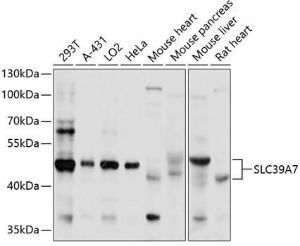 Anti-ZIP7 antibody