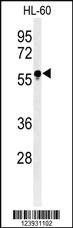 Anti-FUT6 Rabbit Polyclonal Antibody