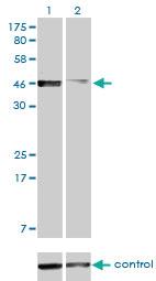 Anti-PBX2 Mouse Monoclonal Antibody [clone: 2E9]