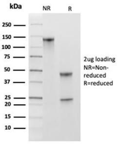 Antibody anti-MCM2 MCM23678 100 µg