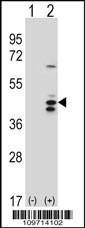 Anti-RCL1 Rabbit Polyclonal Antibody (AP (Alkaline Phosphatase))