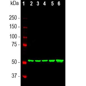 Anti-Vimentin antibody