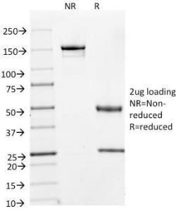 SDS-PAGE analysis of Anti-Cyclin A2 Antibody [E67] under non-reduced and reduced conditions; showing intact IgG and intact heavy and light chains, respectively. SDS-PAGE analysis confirms the integrity and purity of the antibody