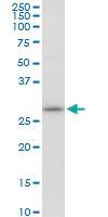 Anti-MAPRE1 Mouse Polyclonal Antibody