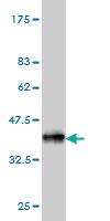 Anti-CPNE1 Mouse Monoclonal Antibody [clone: 8B8]