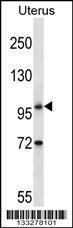 Anti-ATG9B Rabbit Polyclonal Antibody (Biotin)