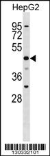 Anti-SLC2A9 Rabbit Polyclonal Antibody