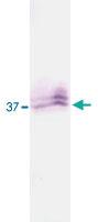 Anti-KLK5 Rabbit Polyclonal Antibody