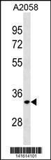 Anti-ELOVL3 Rabbit Polyclonal Antibody (Biotin)