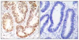 Anti-p38 MAPK alpha Rabbit Polyclonal Antibody