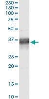 Anti-PLSCR1 Antibody Pair