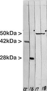 Western blot of crude extract of the human carcinoma HeLa cell line