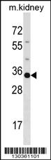 Anti-POU5F2 Rabbit Polyclonal Antibody