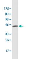 Anti-TM4SF4 Mouse Monoclonal Antibody [clone: 4E6]