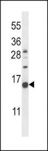 Anti-NPPC Rabbit Polyclonal Antibody (AP (Alkaline Phosphatase))